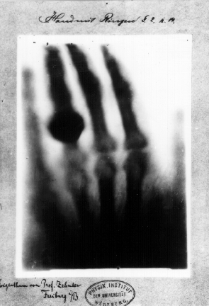 First_medical_X-ray_by_Wilhelm_Röntgen_of_his_wife_Anna_Bertha_Ludwig's_hand_-_18951222 First Medical X-Ray By Wilhelm Roentgen of His Wife's Hand